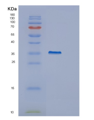 Recombinant Human GULP1 Protein,Recombinant Human GULP1 Protein