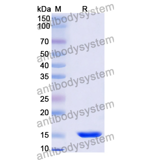 抗 Human CDH17/Cadherin-17 納米抗體 (SAA0804)(RHG31401),Anti-Human CDH17/Cadherin-17 Nanobody (SAA0804)