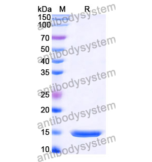 抗 Influenza A virus/H1N1 NP/Nucleoprotein 納米抗體 (SAA1023)(RVV03303),Anti-Influenza A virus/H1N1 NP/Nucleoprotein Nanobody (SAA1023)