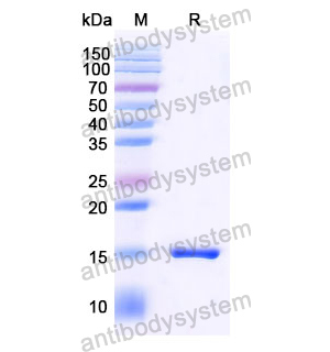 抗 SARS-CoV-2 S Protein 纳米抗体 (SAA1070)(RVV00159),Anti-SARS-CoV-2 S Protein Nanobody (SAA1070)