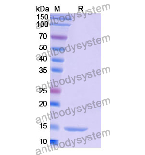 抗 Human RHOB 納米抗體 (SAA0880)(RHF52802),Anti-Human RHOB Nanobody (SAA0880)