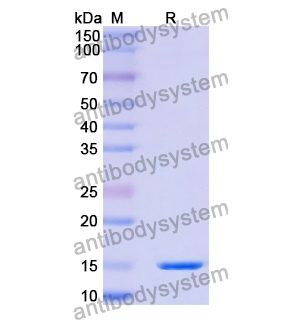 抗 Human RECQL5 納米抗體 (SAA1135)(RHB42601),Anti-Human RECQL5 Nanobody (SAA1135)