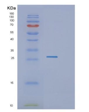 Recombinant Human GZMH Protein,Recombinant Human GZMH Protein