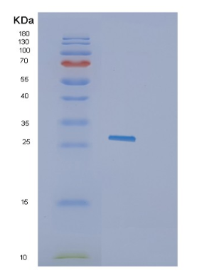 Recombinant Human GZMK Protein,Recombinant Human GZMK Protein