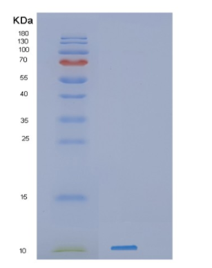 Recombinant Human H mgN1 Protein,Recombinant Human H mgN1 Protein