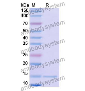 抗 Human CD11a/ITGAL 納米抗體 (SAA1305)(RHD41002),Anti-Human CD11a/ITGAL Nanobody (SAA1305)