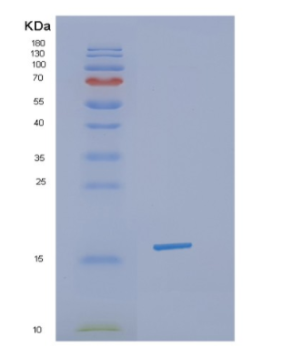 Recombinant Human H3F3A Protein,Recombinant Human H3F3A Protein