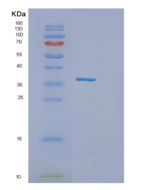 Recombinant Human Influenza A-H3N2/HA Protein,Recombinant Human Influenza A-H3N2/HA Protein