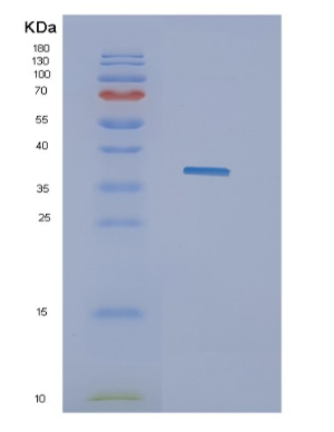 Recombinant Influenza A (H5N1)H5N1/HA Protein,Recombinant Influenza A (H5N1)H5N1/HA Protein