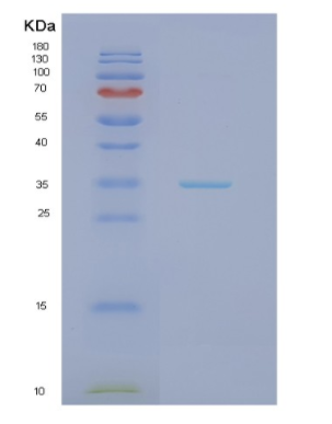 Recombinant Human HADH Protein,Recombinant Human HADH Protein