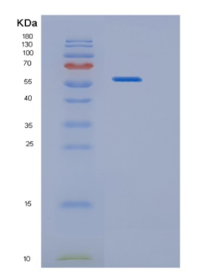 Recombinant Human HARS Protein,Recombinant Human HARS Protein