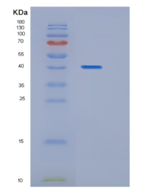 Recombinant Human HAT1 Protein,Recombinant Human HAT1 Protein