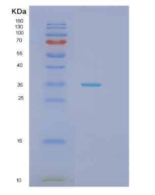 Recombinant Human HAUS1 Protein,Recombinant Human HAUS1 Protein