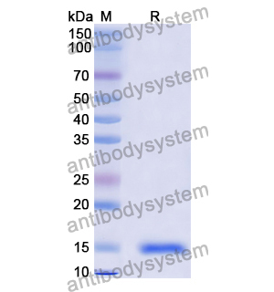 抗 Vibrio cholerae higB-2 納米抗體 (SAA0850)(RXX10101),Anti-Vibrio cholerae higB-2 Nanobody (SAA0850)