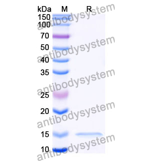 抗 Clostridium botulinum botA/BOTOX 納米抗體 (SAA0932)(RXX00912),Anti-Clostridium botulinum botA/BOTOX Nanobody (SAA0932)