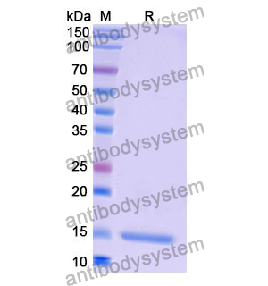 抗 Human CD184/CXCR4 納米抗體 (SAA1262)(RHF39901),Anti-Human CD184/CXCR4 Nanobody (SAA1262)