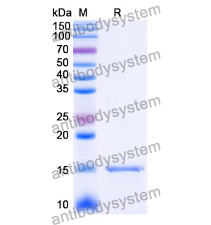 抗 Human CD38/ADPRC 1 納米抗體 (SAA1116)(RHD80804),Anti-Human CD38/ADPRC 1 Nanobody (SAA1116)