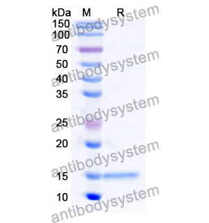 抗 Human RECQL5 納米抗體 (SAA1133)(RHB42608),Anti-Human RECQL5 Nanobody (SAA1133)