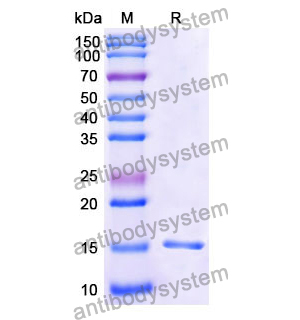 抗 Human CD122/IL2RB 納米抗體 (SAA1051)(RHD06901),Anti-Human CD122/IL2RB Nanobody (SAA1051)