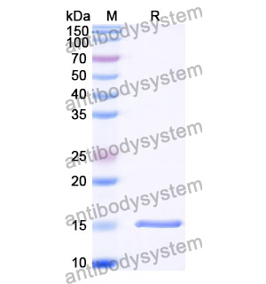 抗 Vibrio cholerae serotype O1 ctxB/Cholera Toxin Subunit B 納米抗體 (SAA1345)(RXX05805),Anti-Vibrio cholerae serotype O1 ctxB/Cholera Toxin Subunit B Nanobody (SAA1345)