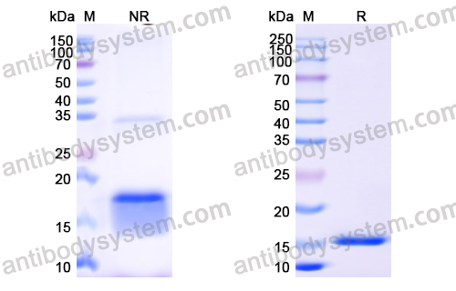 抗 Human EGFR/ERBB1/HER1 納米抗體 (SAA1207)(RHB86904),Anti-Human EGFR/ERBB1/HER1 Nanobody (SAA1207)