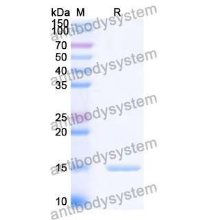 抗 Human CD66e/CEA/CEACAM5 纳米抗体 (SAA0837)(RHC21002),Anti-Human CD66e/CEA/CEACAM5 Nanobody (SAA0837)