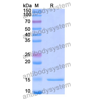 抗 Human HTT 纳米抗体 (SAA1178)(RHE38301),Anti-Human HTT Nanobody (SAA1178)