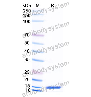 抗 Human RAGE-1/MOK 納米抗體 (SAA1290)(RHJ83001),Anti-Human RAGE-1/MOK Nanobody (SAA1290)