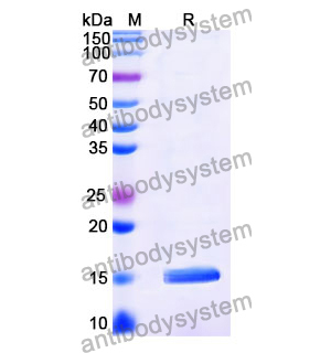 抗 Vibrio cholerae serotype O1 higB-2 納米抗體 (SAA1174)(RXX10107),Anti-Vibrio cholerae serotype O1 higB-2 Nanobody (SAA1174)