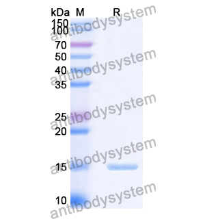 抗 Human CD284/TLR4 纳米抗体 (SAA1263)(RHA05301),Anti-Human CD284/TLR4 Nanobody (SAA1263)