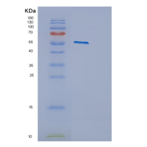 Recombinant Human CYP2E1 Protein