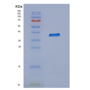 Recombinant Human CYTH3 Protein,Recombinant Human CYTH3 Protein