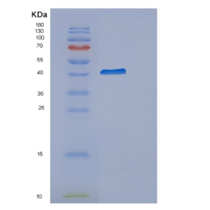 Recombinant Human CYTIP Protein,Recombinant Human CYTIP Protein