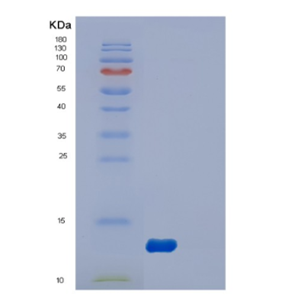 Recombinant Human DYNLL2 Protein