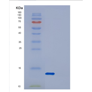 Recombinant Human DYNLRB2 Protein,Recombinant Human DYNLRB2 Protein