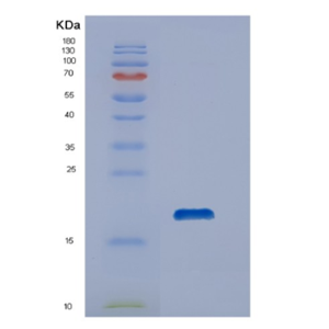 Recombinant Human DUSP19 Protein