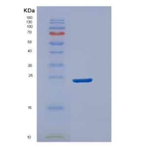 Recombinant Human DUSP18 Protein
