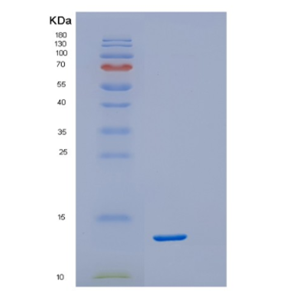 Recombinant Human DSCR1 isoform b Protein