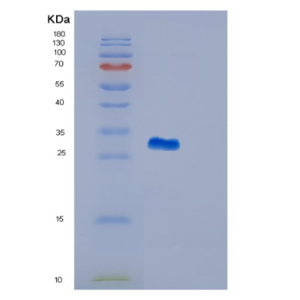 Recombinant Human GSTM4 Protein,Recombinant Human GSTM4 Protein