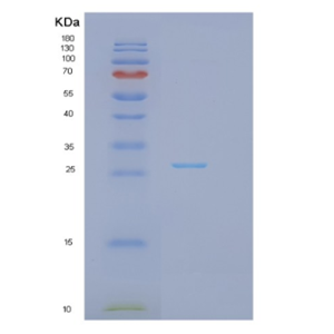 Recombinant Human GSTP1 Protein