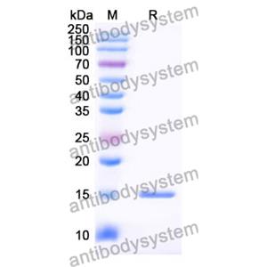 抗 Human SP140 纳米抗体 (SAA0901)(RHG49201),Anti-Human SP140 Nanobody (SAA0901)