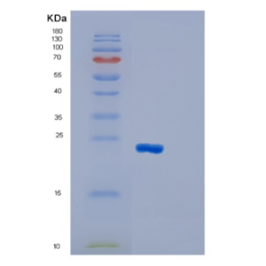 Recombinant Human GSTM1 Protein,Recombinant Human GSTM1 Protein