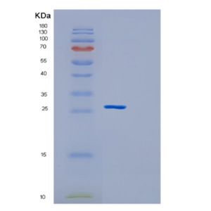 Recombinant Human GSTM2 Protein,Recombinant Human GSTM2 Protein