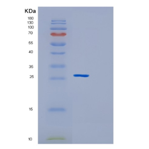 Recombinant Human GSTM2 Protein