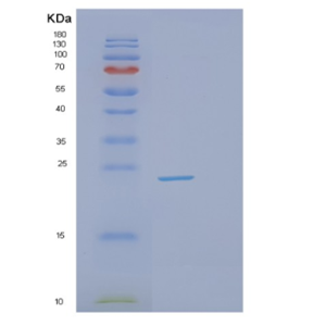 Recombinant Mouse GSTP2 Protein,Recombinant Mouse GSTP2 Protein