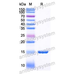 Anti-Human KLB/Beta-klotho Nanobody (SAA1090)