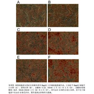 BSA偶聯(lián)油酸鈉溶液（常溫?zé)o析出、常溫?zé)o沉淀、無需加熱助溶、直接使用、100%濃度準(zhǔn)確）,BSA-sodium oleate