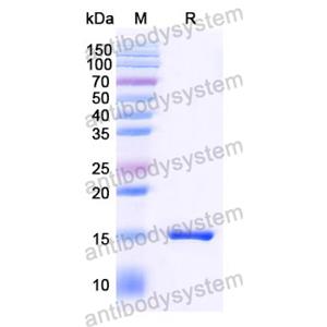 抗 SARS-CoV-2 S Protein 纳米抗体 (SAA1070)(RVV00159),Anti-SARS-CoV-2 S Protein Nanobody (SAA1070)