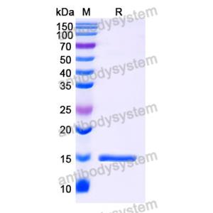 抗 SARS-CoV-2 S Protein 納米抗體 (SAA1027)(RVV00142),Anti-SARS-CoV-2 S Protein Nanobody (SAA1027)