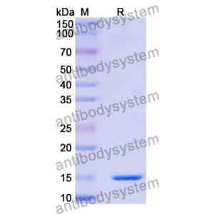 Anti-Human RECQL5 Nanobody (SAA1135)